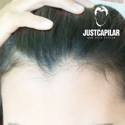 Rosto com cabelos pretos e logotipo JUSTCAPILAR