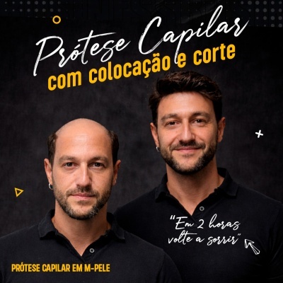 Dois homens, um com prótese capilar visível e outro sem, sobre fundo escuro com texto promocional
