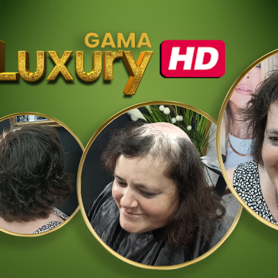 Transformação capilar desde calvície até cabelo curto e encaracolado com fundo verde e texto Luxury HD