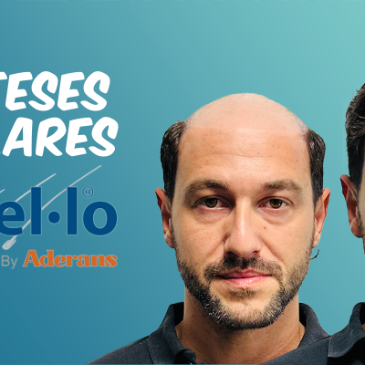 Antes e depois de um homem com e sem prótese capilar, texto PRÓTESES CAPILARES Capel·lo By Aderans em fundo azul