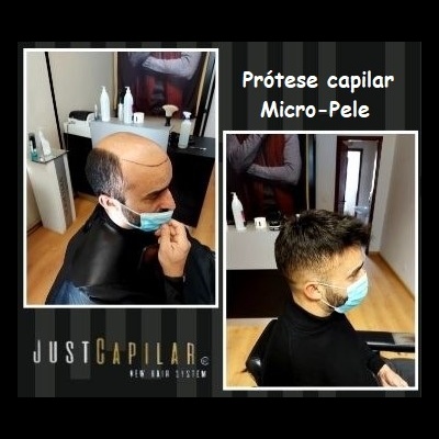 Antes e depois da aplicação de prótese capilar micro-pele em homem num salão