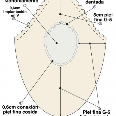 Diagrama técnico de produto com componentes em pele fina e tul monofilamento com medidas anotadas