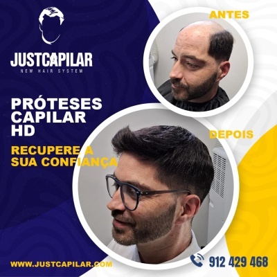 Imagem de antes e depois de prótese capilar com texto promocional da JUSTCAPILAR.