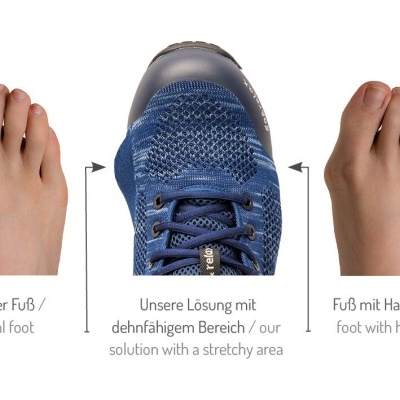 Sapatilha&#x20;joanetes&#x20;halux-valgus&#x20;Baak