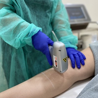 Dispositivo estético cinzento aplicado na perna de uma pessoa por profissional com luvas azuis e bata verde