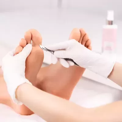 Pessoa a cuidar das unhas dos pés com luvas e instrumento de metal.