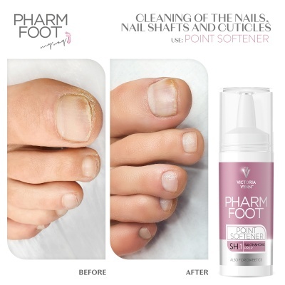 Antes e depois do uso do PHARM FOOT POINT SOFTENER para limpeza de unhas e cutículas e embalagem do produto
