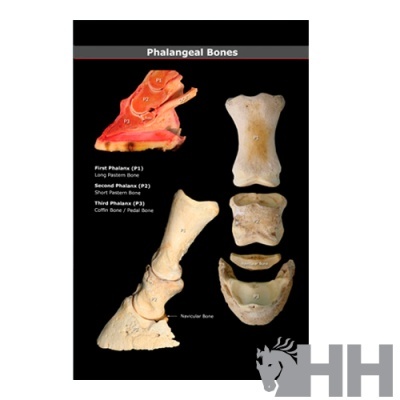 Poster educativo com ossos das falanges e texto descritivo em inglês, fundo preto e logótipo HH