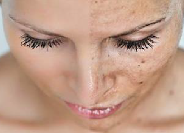 Rosto feminino em close-up com pele limpa e cílios longos
