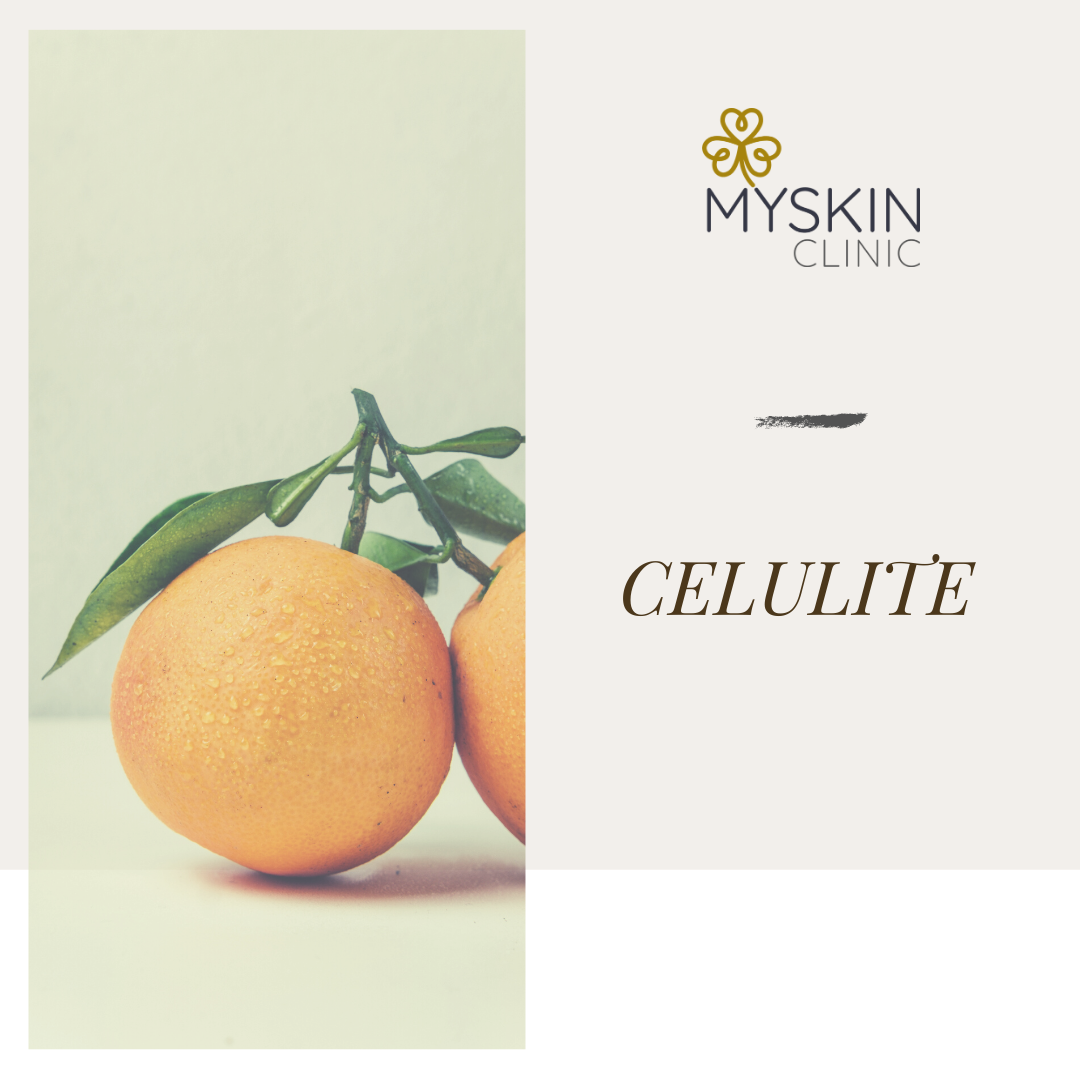 Duas laranjas com folhas verdes e texto MY SKIN CLINIC CELULITE em fundo bege claro