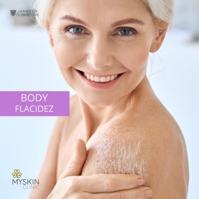 Mulher madura com creme corporal branco no ombro e texto Body Flacidez