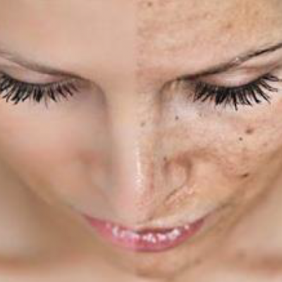 Rosto feminino em close-up com pele limpa e cílios longos
