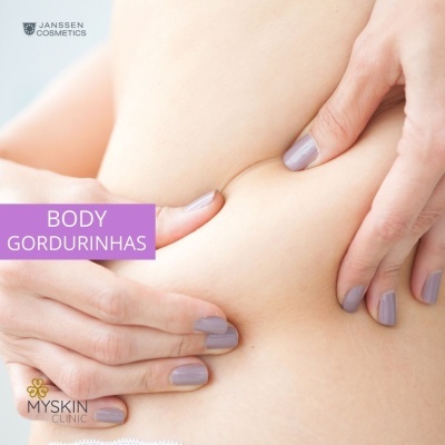 Mão com unhas lilás apertando dobra de pele com texto BODY GORDURINHAS