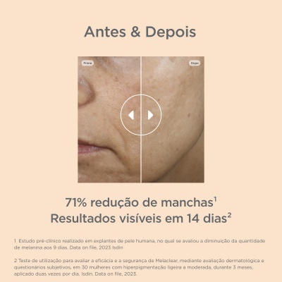 Antes e Depois de redução de manchas no rosto com texto promocional em português