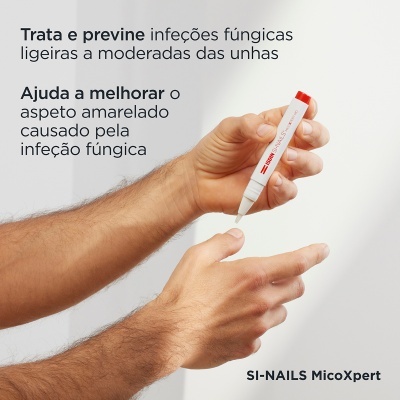 Tubo branco com tampa vermelha segurado por mãos masculinas com texto em português sobre infeções fúngicas das unhas