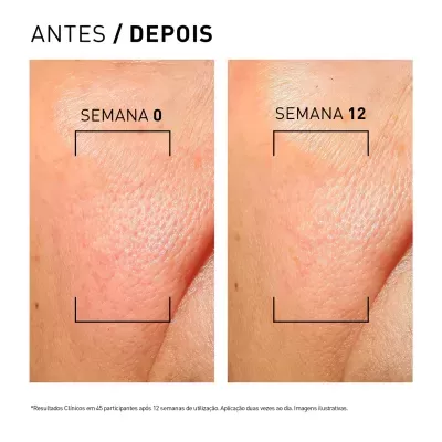 Comparação de pele antes e depois com indicação de semana 0 e semana 12