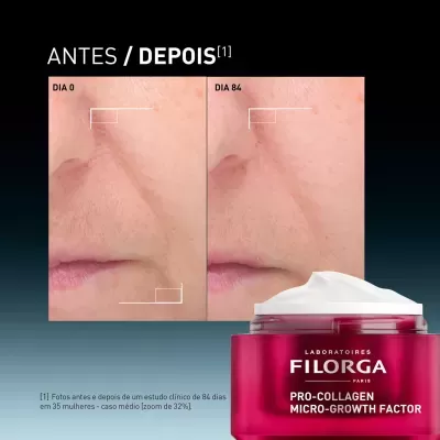 Antes e depois da pele tratada com creme FILORGA PRO-COLLAGEN MICRO-GROWTH FACTOR