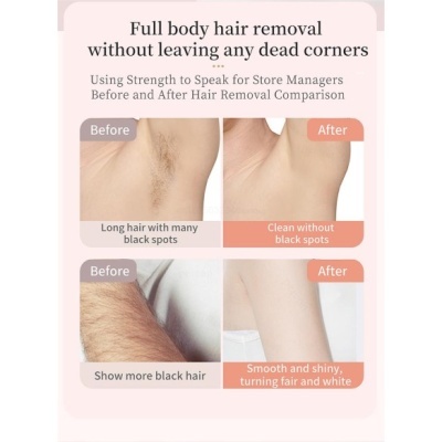 Comparação antes e depois da remoção de pelos corporais nas axilas e braço