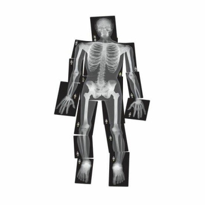 Montagem de imagens de raios-X formando figura humana completa