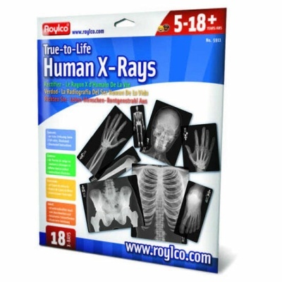 Pacote de cartões educacionais com imagens de raios-X humanos
