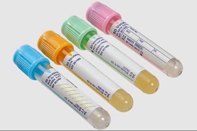 Quatro tubos de recolha de sangue com tampas coloridas e etiquetas em branco