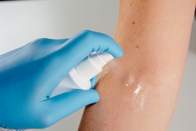 Pessoa com luva azul a aplicar spray transparente num braço