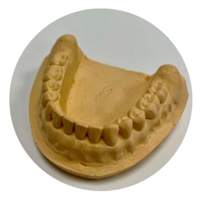 Molde dental inferior em gesso de cor bege com detalhes dos dentes
