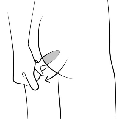 Ilustração de aplicação de adesivo na parte interna da coxa