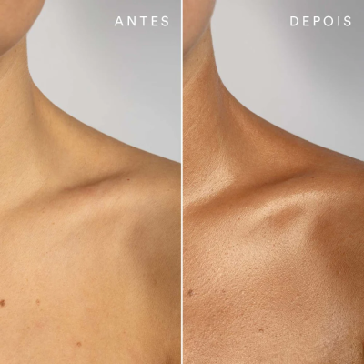 Comparação de pele antes e depois em ombro e pescoço