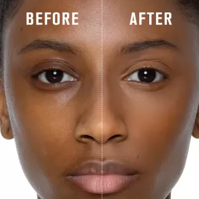 Rosto dividido ao meio com texto BEFORE e AFTER mostrando diferença na pele