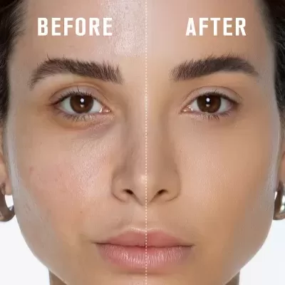 Rosto feminino com comparação antes e depois de produto cosmético