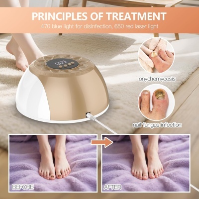 Dispositivo de tratamento para fungo nas unhas dos pés com luz LED e imagens de antes e depois