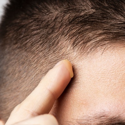 Pessoa com cabelo curto encostando o dedo na testa