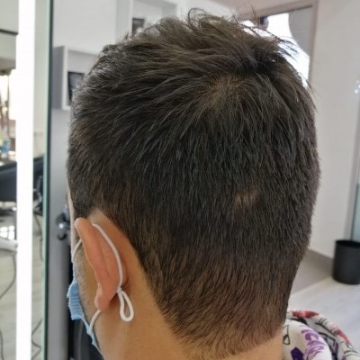 Parte traseira da cabeça de pessoa com cabelo curto castanho e máscara azul com cordão na orelha