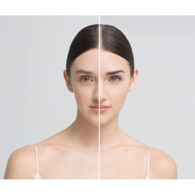 Rosto de mulher jovem com metade do rosto mostrando diferença de aparência