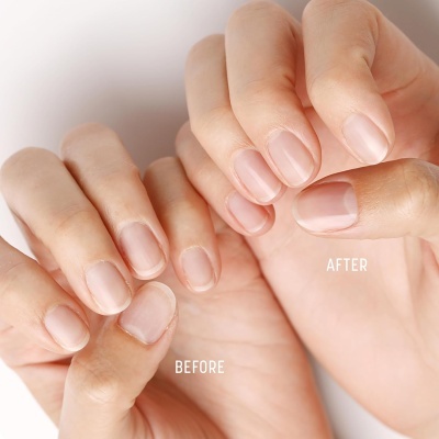 Antes e depois de unhas naturais, mostrando diferença de comprimento e limpeza.