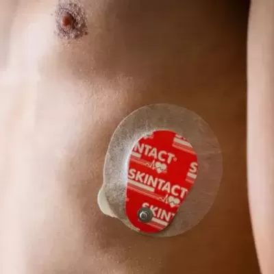 Adesivo médico Skintact vermelho e branco na pele de um peito