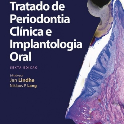 Capa de livro sobre periodontia e implantologia oral com imagem de tecido biológico