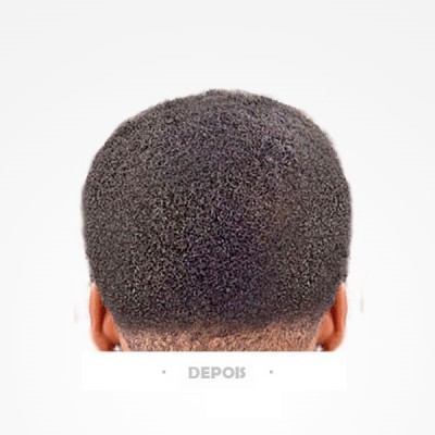 Cabelo crespo preto visto de trás sobre fundo branco com palavra DEPOIS