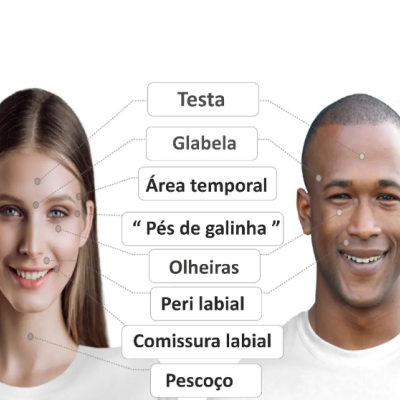 AVALON&#x2122;&#x20;Fine&#x20;Plus&#x20;&#x00C1;cido&#x20;Hialur&#x00F3;nico&#x20;Reticulado