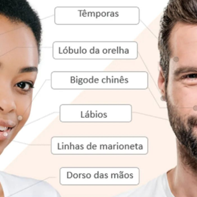 AVALON&#x2122;&#x20;Vital&#x20;Plus&#x20;&#x00C1;cido&#x20;Hialur&#x00F3;nico&#x20;Reticulado&#x20;L&#x00E1;bios