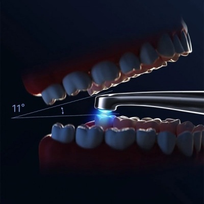 Dispositivo metálico com luz azul entre dentes superiores e inferiores num ângulo de 11 graus.