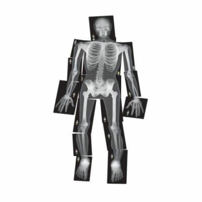 Radiografias formando imagem de esqueleto humano em várias partes