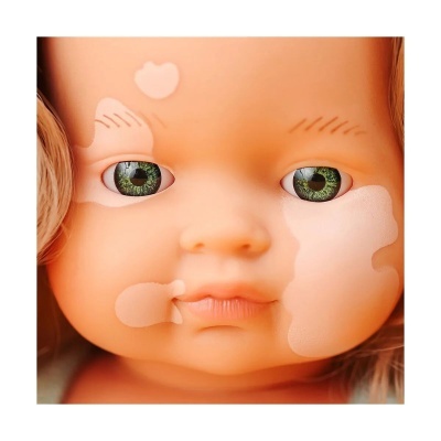 Rosto de boneca com olhos verdes e manchas claras na pele