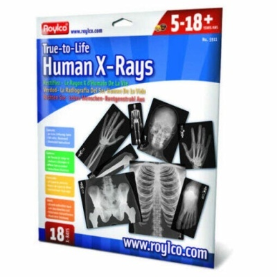 Embalagem educativa com imagens de raios-X humanas