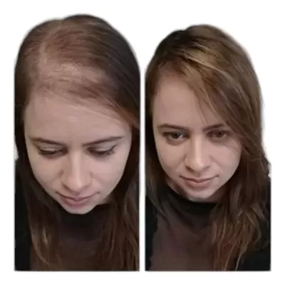 T&#x00F4;nico&#x20;Poderoso&#x20;&#x7C;&#x20;60&#x20;C&#x00E1;psulas&#x20;-&#x20;Cresc&#x20;Acelerado&#x20;&#x7C;&#x20;Anti-queda&#x20;Gold&#x20;Spell