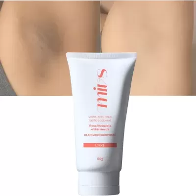 Creme clareador corporal Sanius em tubo branco com texto vermelho e imagens de antes e depois no fundo.