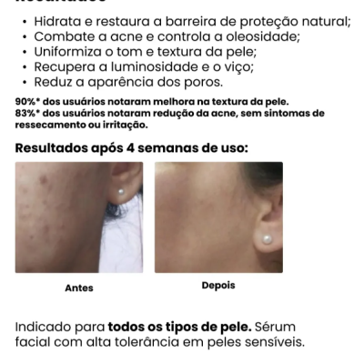 Texto com descrição dos resultados de sérum facial, antes e depois de uso, em português