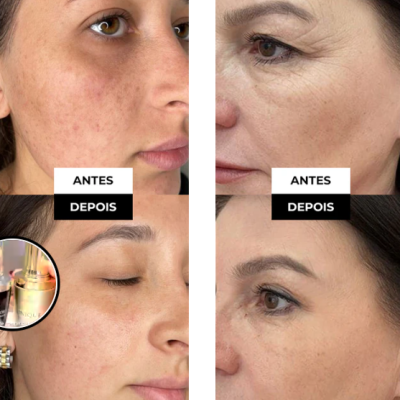 Kit&#x20;Dia&#x20;Noite&#x20;Serum&#x20;Visage&#x20;E&#x20;Unique&#x20;Saviora&#x20;Skincare&#x20;Rugas