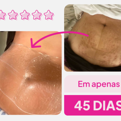&#x1F64B;REVENDA&#x1F64B;-&#x20;Creme&#x20;Adeus&#x20;Multifuncional&#x20;300g